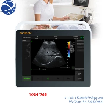 CE Sunbright ultrazvok kozmetični medicinske zaslon na dotik ultrazvok prenosni ultrazvočni instrument